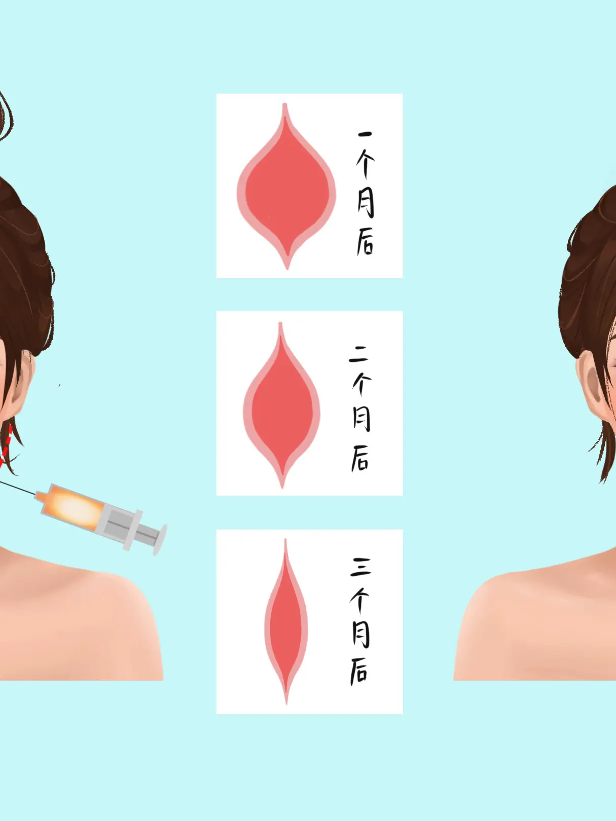 瘦臉針科普小課堂漫畫封面图片