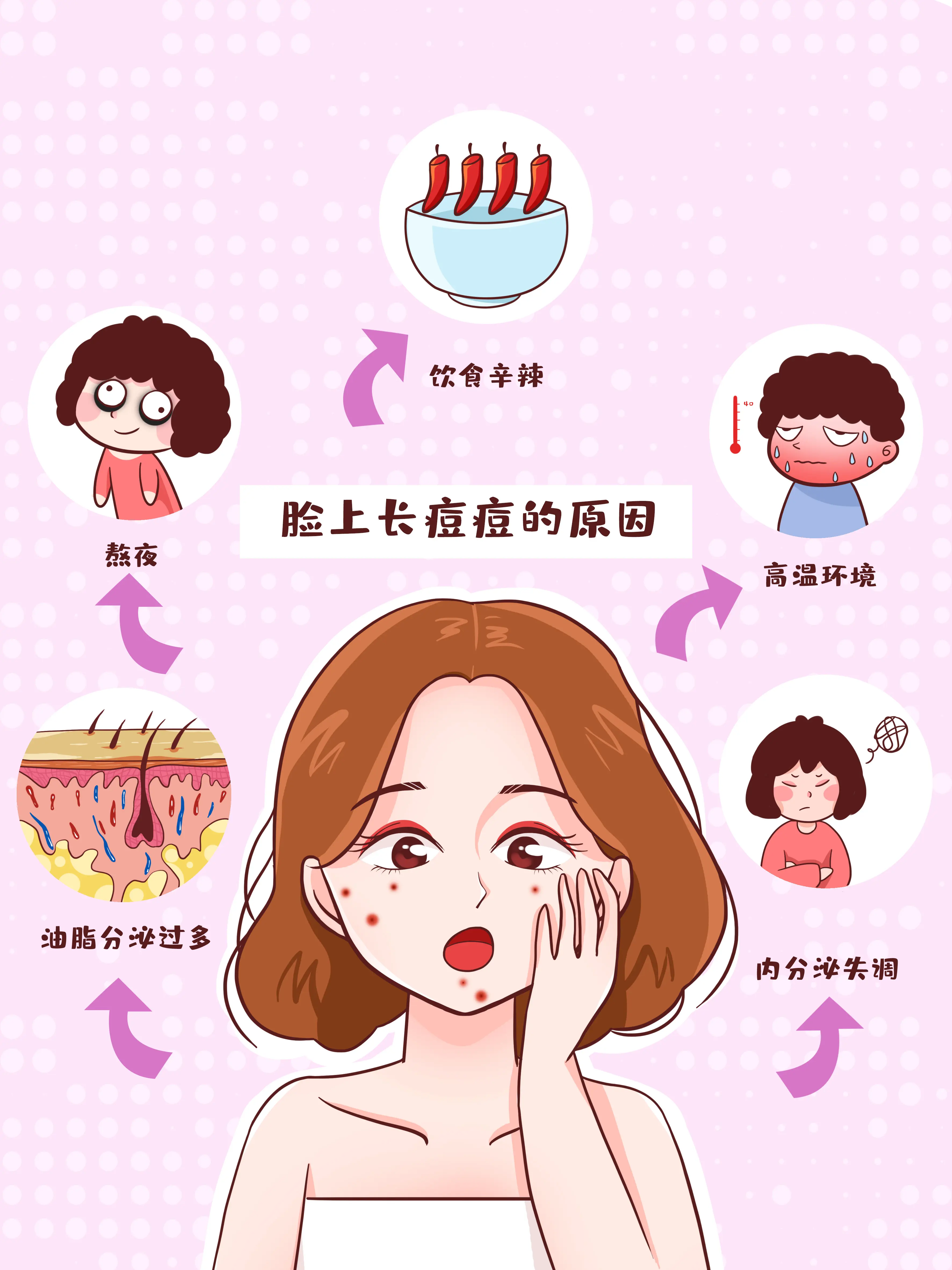 長痘痘原因科普漫畫封面图片