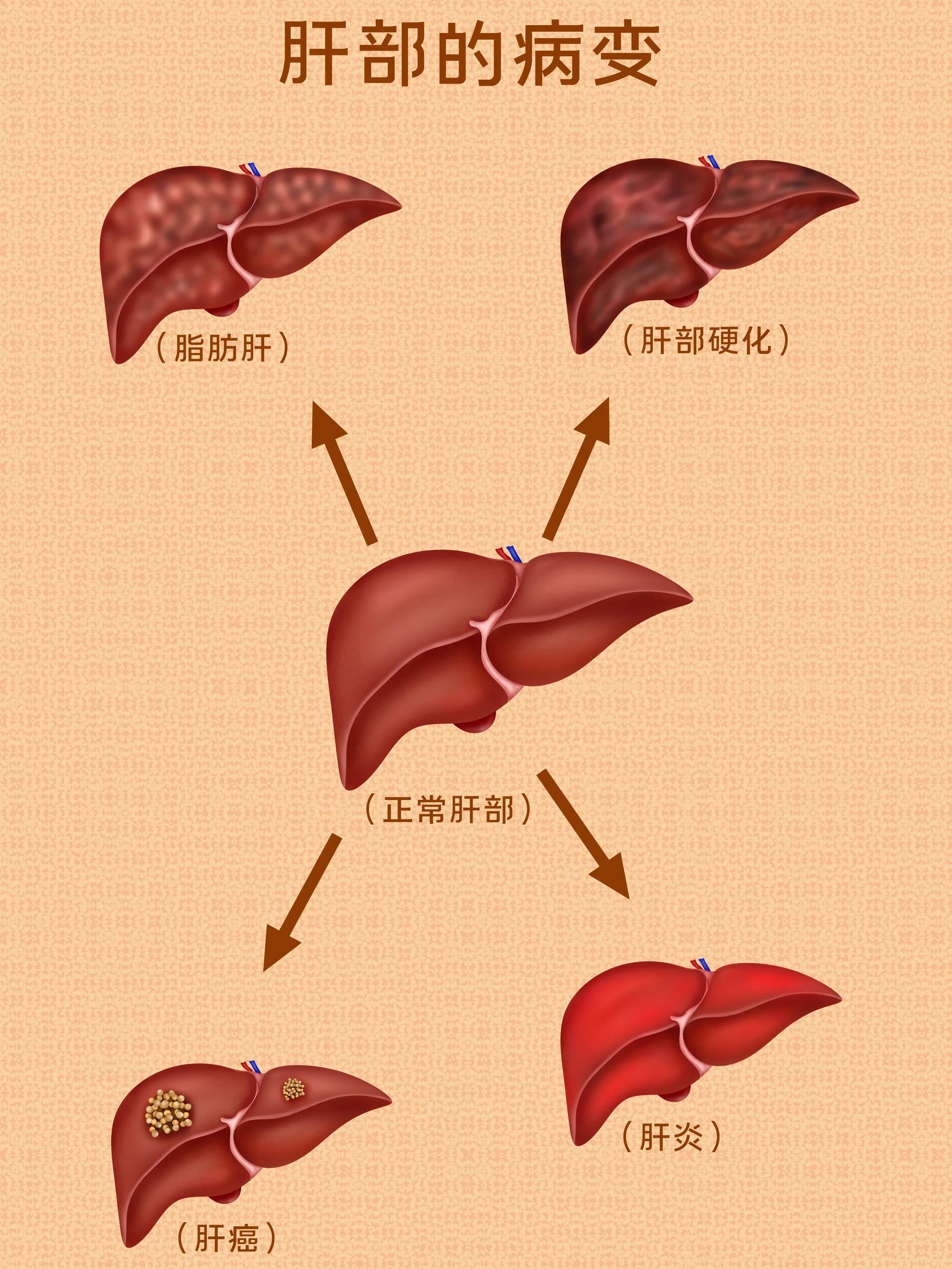 心髒病變知識小科普漫畫封面图片