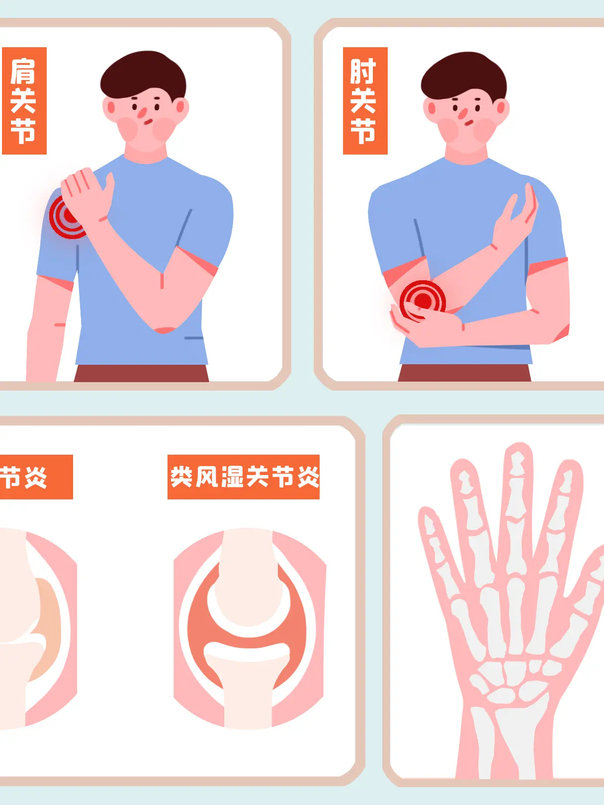 關節炎知識小科普漫畫封面图片