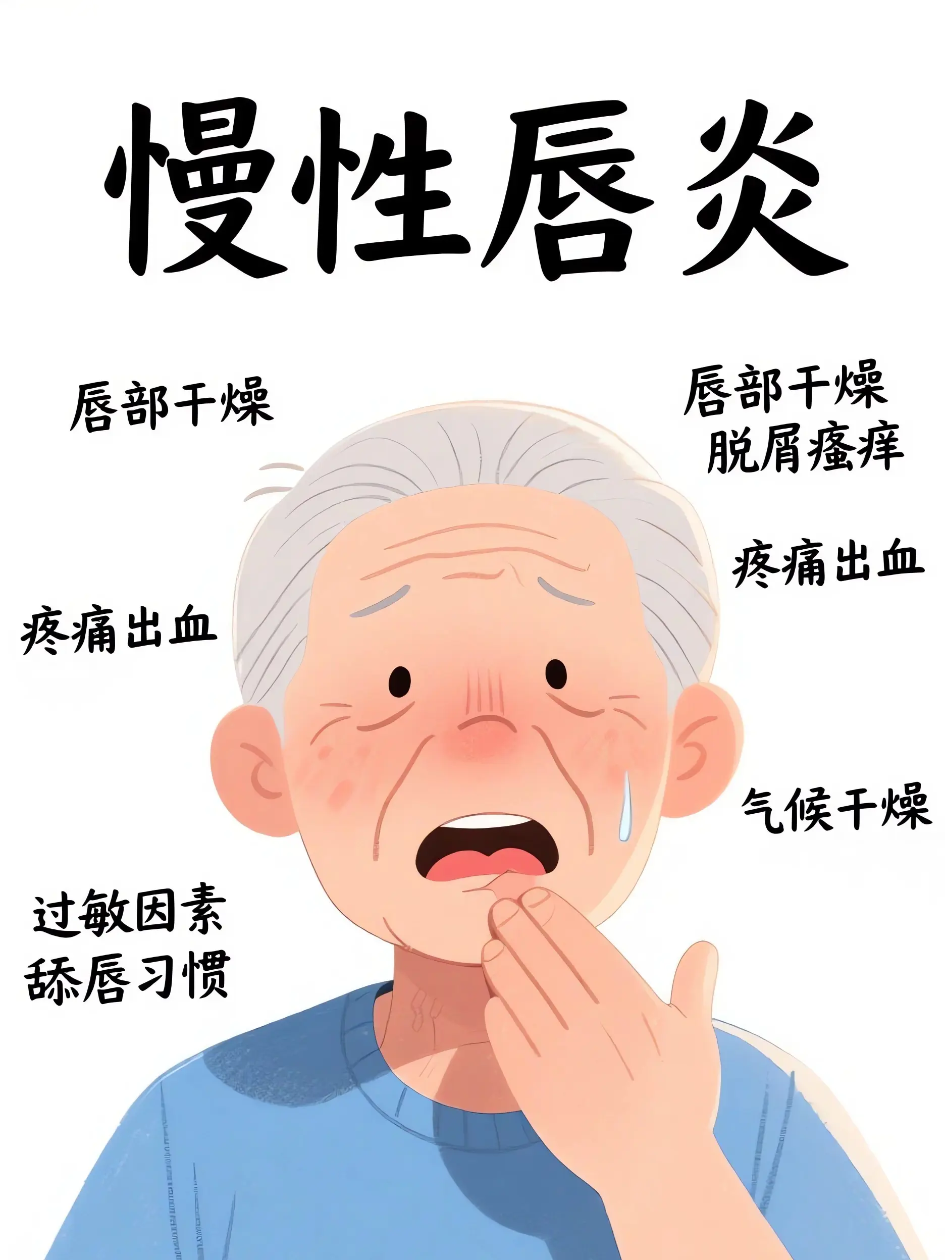 唇炎反複？別忽視！漫畫封面图片